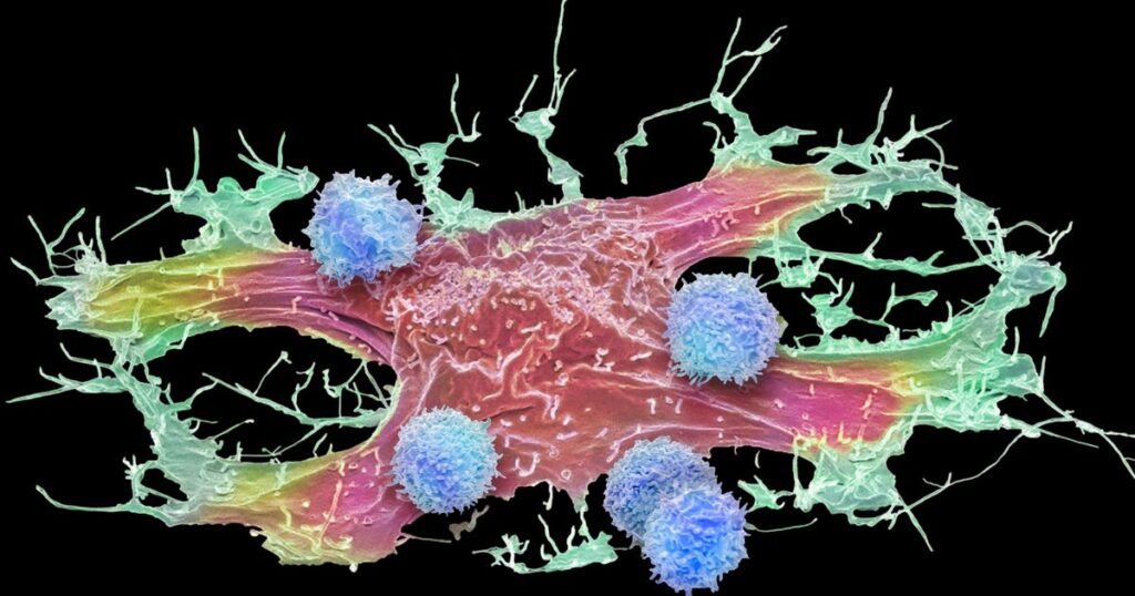 Le cellule piccole e alterate peggiorano il cancro