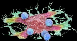 Le cellule piccole e alterate peggiorano il cancro